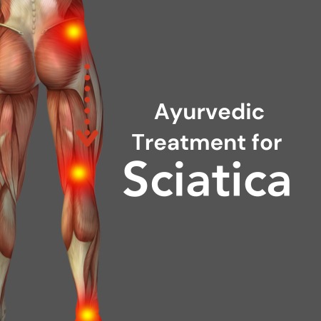 Sciatica